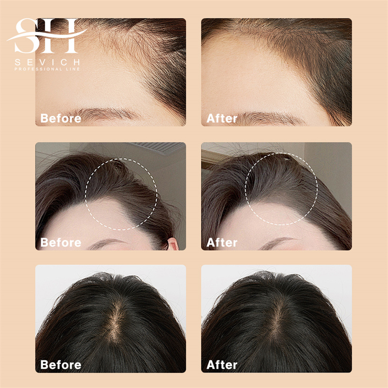 SEVICH 12g Hairline Powder Wit – обзор и цена Rooting Hormone Powder